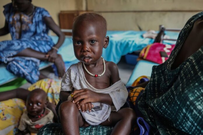 Adut Duor, 14 months old, sits on his mother's lap in the malnutrition ward of Bunj Hospital in Maban, South Sudan, Monday, Aug. 18, 2025. (AP Photo/Caitlin Kelly)